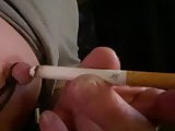 Nipple burne sigaret 